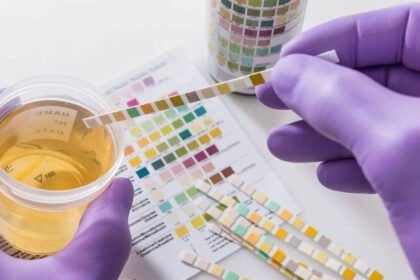 Your urine colour could be warning you about hidden health problems, what every shade really means