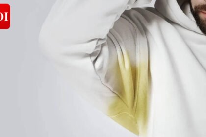Yellow Sweat Stains: How to get rid of yellow sweat stains |